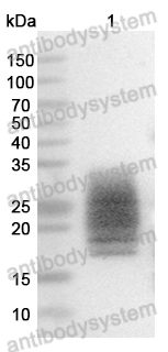Anti-Monkeypox virus/MPXV M1R Polyclonal Antibody